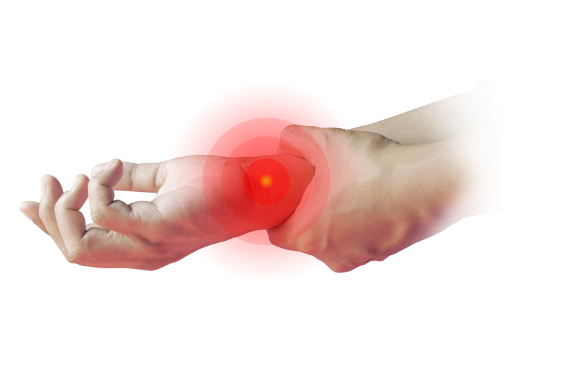 Read more about the article What is Peripheral Neuropathy?
